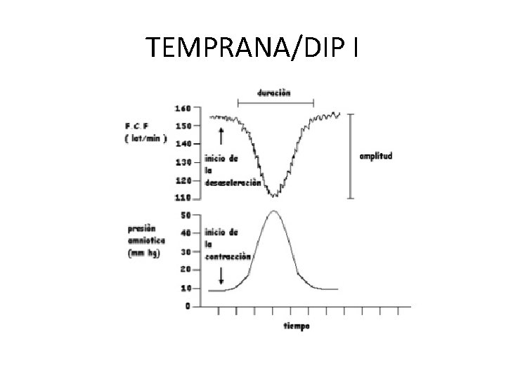 TEMPRANA/DIP I 