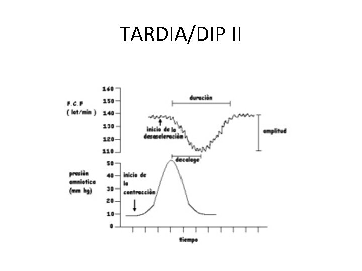 TARDIA/DIP II 