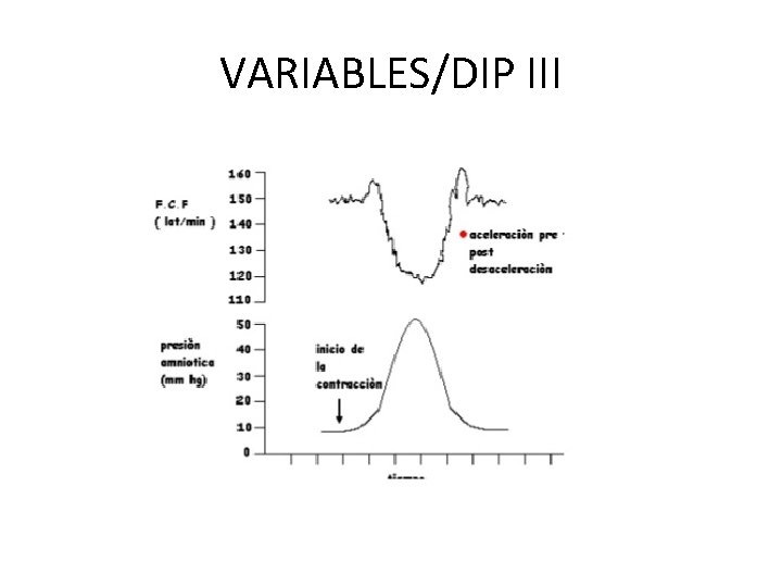 VARIABLES/DIP III 