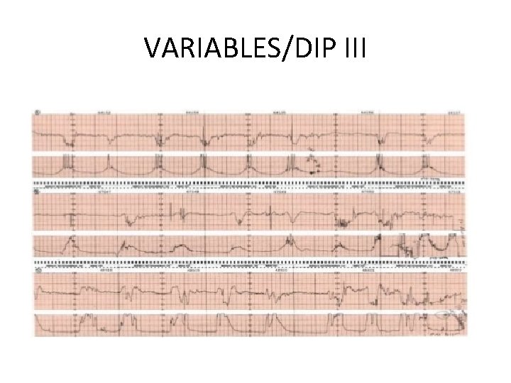 VARIABLES/DIP III 