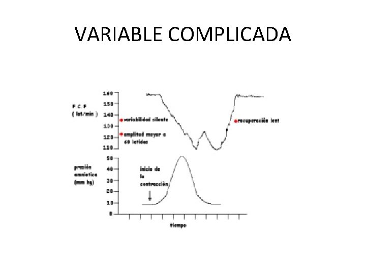 VARIABLE COMPLICADA 