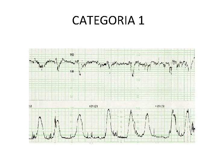 CATEGORIA 1 