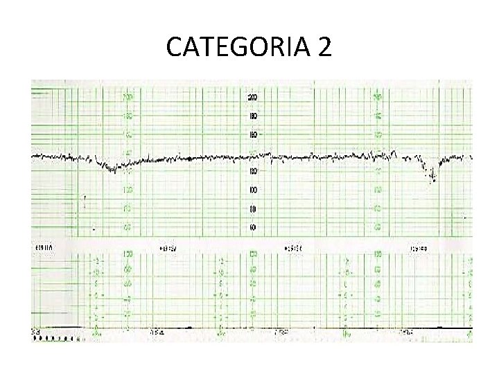 CATEGORIA 2 