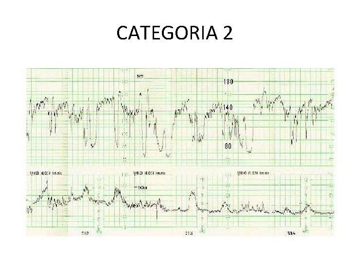 CATEGORIA 2 