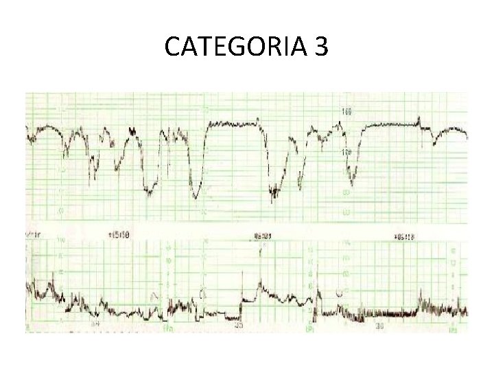 CATEGORIA 3 