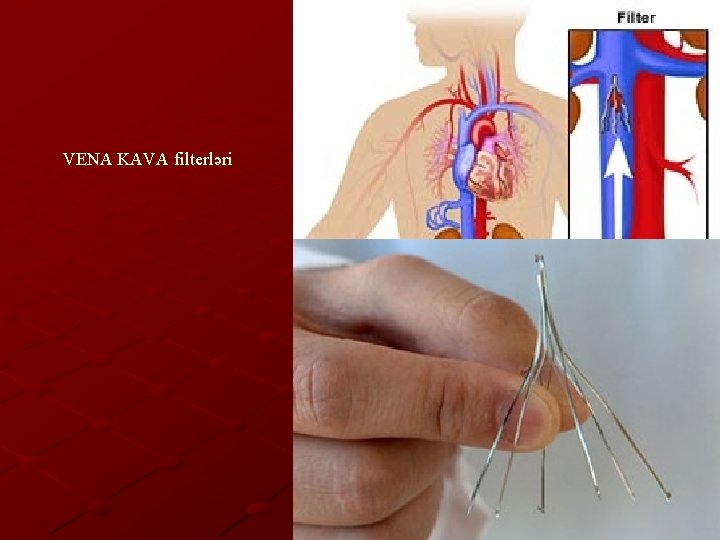 VENA KAVA filterləri 