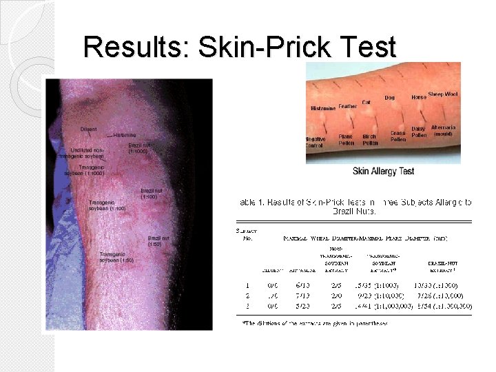 Results: Skin-Prick Test 