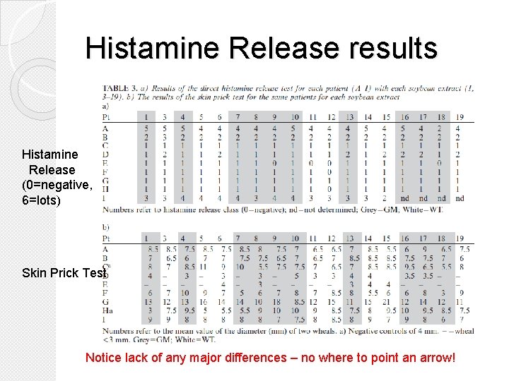 Histamine Release results Histamine Release (0=negative, 6=lots) Skin Prick Test Notice lack of any