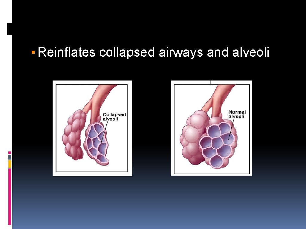▪ Reinflates collapsed airways and alveoli 