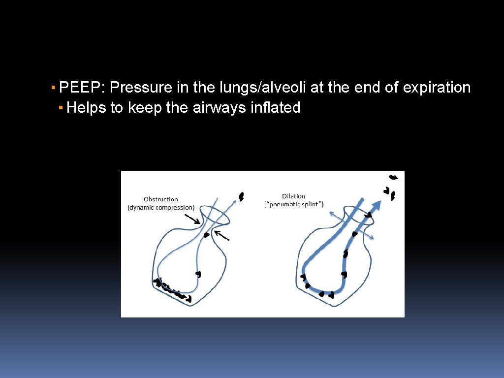 ▪ PEEP: Pressure in the lungs/alveoli at the end of expiration ▪ Helps to