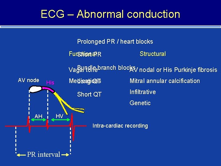 ECG – Abnormal conduction Prolonged PR / heart blocks Functional Short PR Structural Bundle