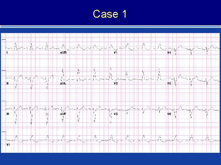 Case 1 