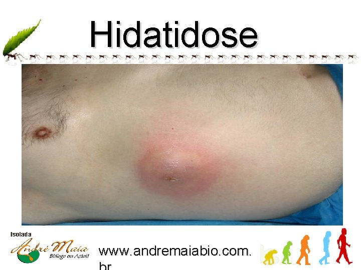 Hidatidose www. andremaiabio. com. 