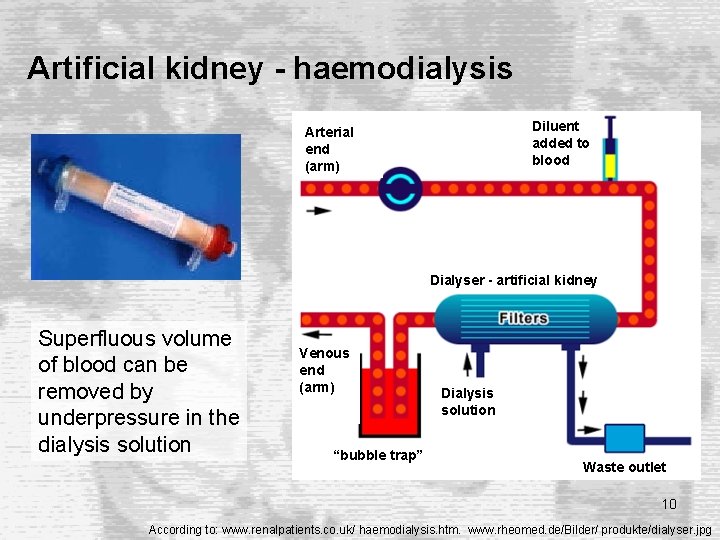 Artificial kidney - haemodialysis Diluent added to blood Arterial end (arm) Dialyser - artificial Artificial kidney - haemodialysis Diluent added to blood Arterial end (arm) Dialyser - artificial