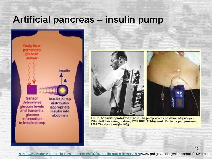 Artificial pancreas – insulin pump 13 http: //www. diabetesaustralia. com. au/conquest/0204 -insulin-pump-therapy. htm www. Artificial pancreas – insulin pump 13 http: //www. diabetesaustralia. com. au/conquest/0204 -insulin-pump-therapy. htm www.