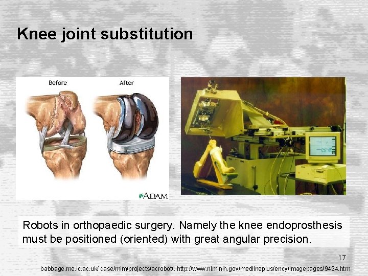 Knee joint substitution Robots in orthopaedic surgery. Namely the knee endoprosthesis must be positioned Knee joint substitution Robots in orthopaedic surgery. Namely the knee endoprosthesis must be positioned