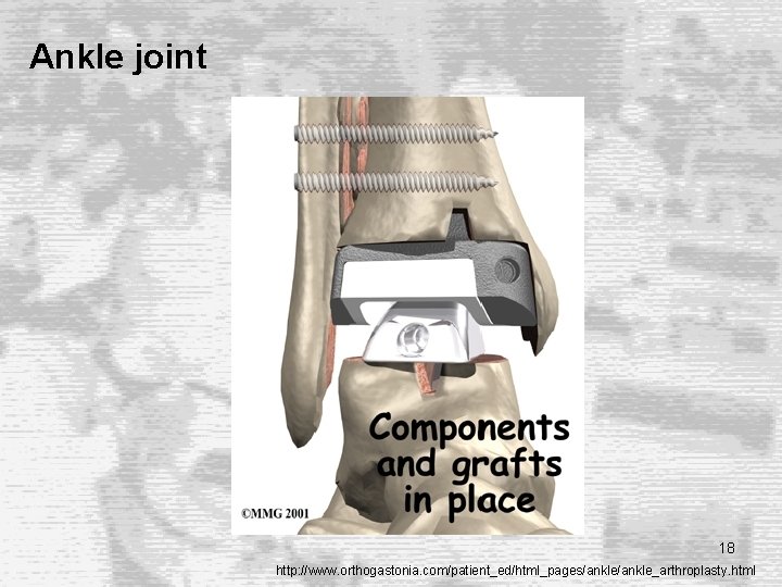 Ankle joint 18 http: //www. orthogastonia. com/patient_ed/html_pages/ankle_arthroplasty. html Ankle joint 18 http: //www. orthogastonia. com/patient_ed/html_pages/ankle_arthroplasty. html