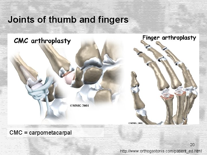 Joints of thumb and fingers CMC = carpometacarpal 20 http: //www. orthogastonia. com/patient_ed. html Joints of thumb and fingers CMC = carpometacarpal 20 http: //www. orthogastonia. com/patient_ed. html