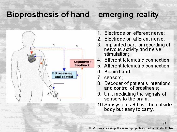 Bioprosthesis of hand – emerging reality 1. Electrode on efferent nerve; 2. Electrode on Bioprosthesis of hand – emerging reality 1. Electrode on efferent nerve; 2. Electrode on