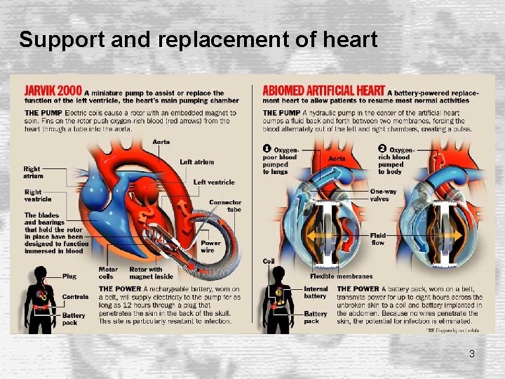 Support and replacement of heart 3 Support and replacement of heart 3