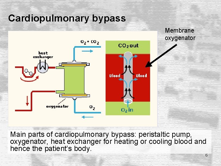 Cardiopulmonary bypass Membrane oxygenator Main parts of cardiopulmonary bypass: peristaltic pump, oxygenator, heat exchanger Cardiopulmonary bypass Membrane oxygenator Main parts of cardiopulmonary bypass: peristaltic pump, oxygenator, heat exchanger