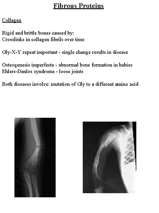 Fibrous Proteins Collagen Rigid and brittle bones caused by: Crosslinks in collagen fibrils over