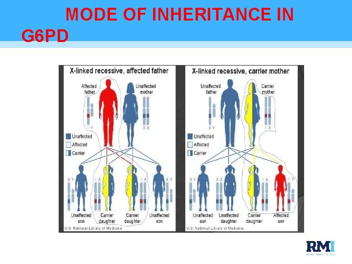 MODE OF INHERITANCE IN G 6 PD 