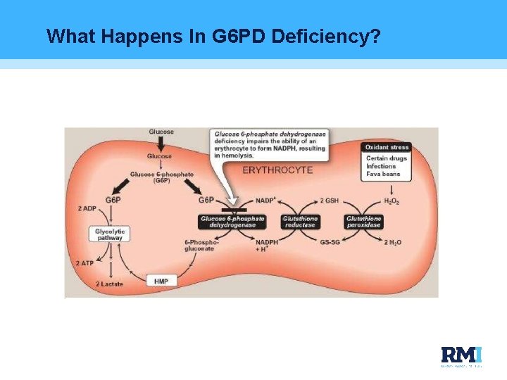 What Happens In G 6 PD Deficiency? 