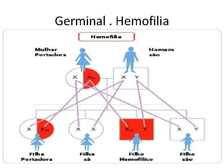 Germinal. Hemofilia 