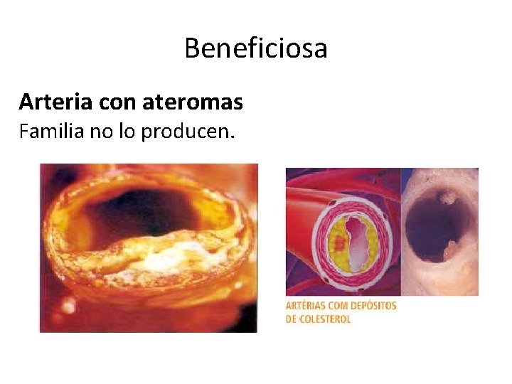 Beneficiosa Arteria con ateromas Familia no lo producen. 