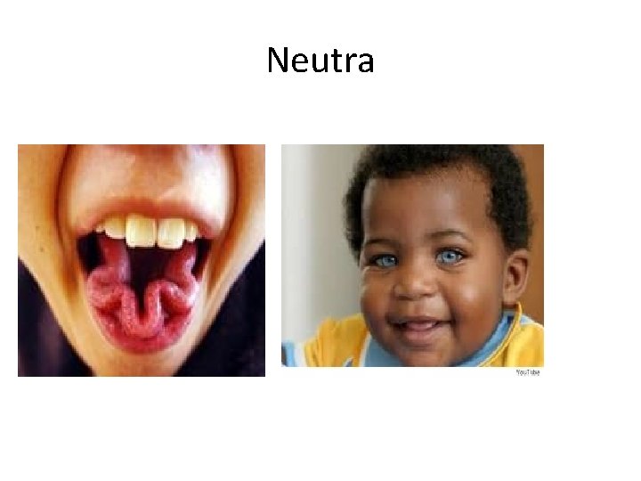 Neutra 