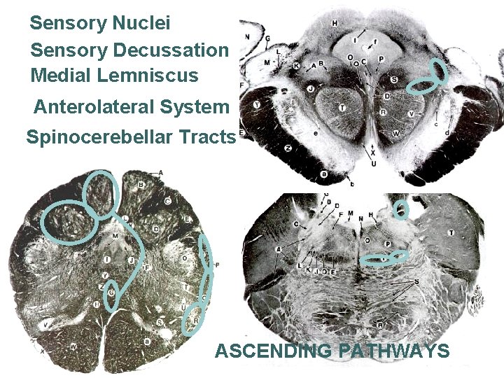 Sensory Nuclei Sensory Decussation Medial Lemniscus Anterolateral System Spinocerebellar Tracts ASCENDING PATHWAYS 