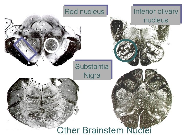 Red nucleus Inferior olivary nucleus Substantia Nigra Other Brainstem Nuclei 