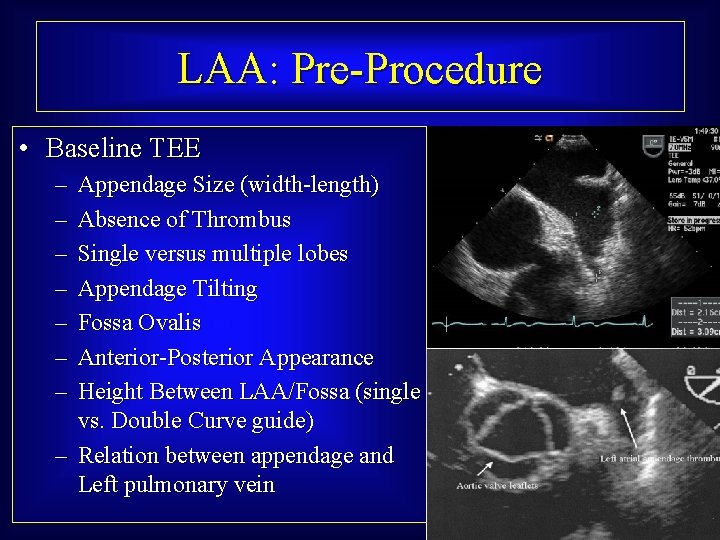 LAA: Pre-Procedure • Baseline TEE – – – – Appendage Size (width-length) Absence of