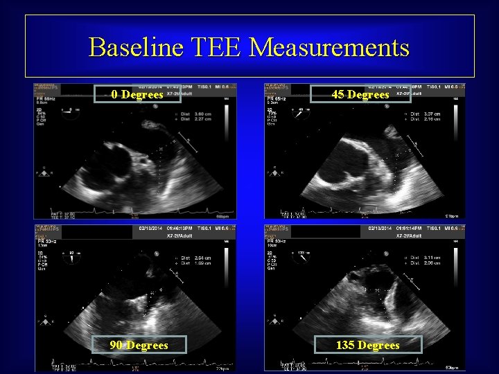 Baseline TEE Measurements 0 Degrees 90 Degrees 45 Degrees 135 Degrees 