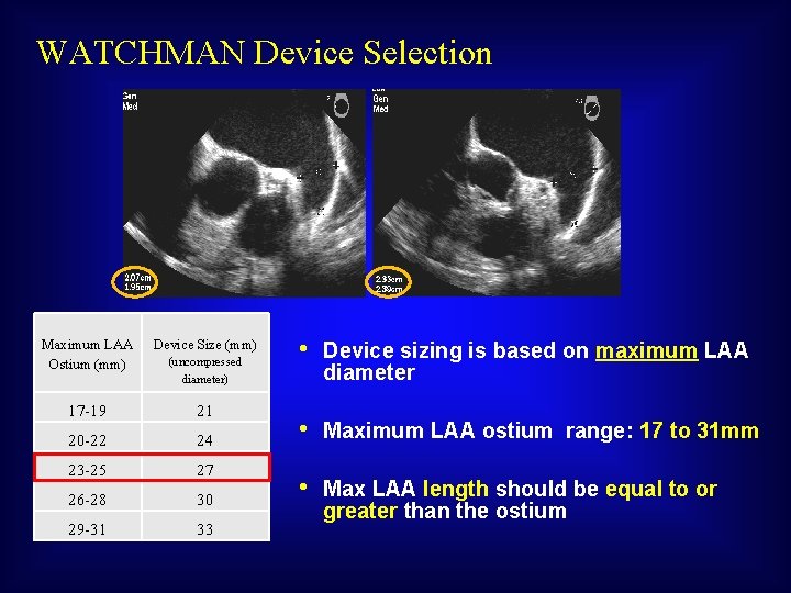 WATCHMAN Device Selection Maximum LAA Ostium (mm) Device Size (mm) 17 -19 21 20