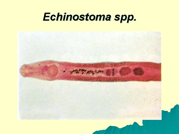 Echinostoma spp. 