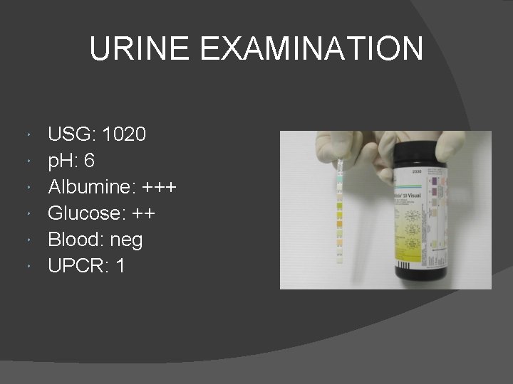 URINE EXAMINATION USG: 1020 p. H: 6 Albumine: +++ Glucose: ++ Blood: neg UPCR: