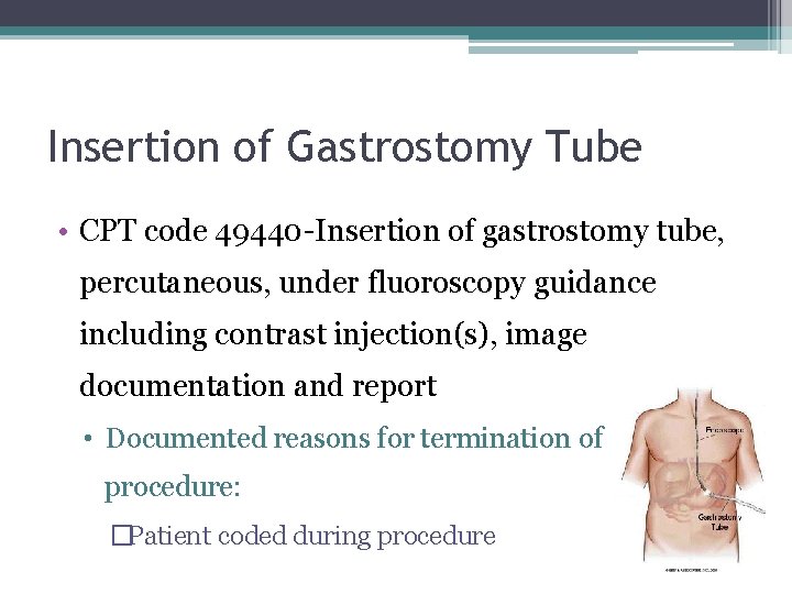 Insertion of Gastrostomy Tube • CPT code 49440 -Insertion of gastrostomy tube, percutaneous, under