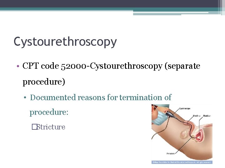 Cystourethroscopy • CPT code 52000 -Cystourethroscopy (separate procedure) • Documented reasons for termination of