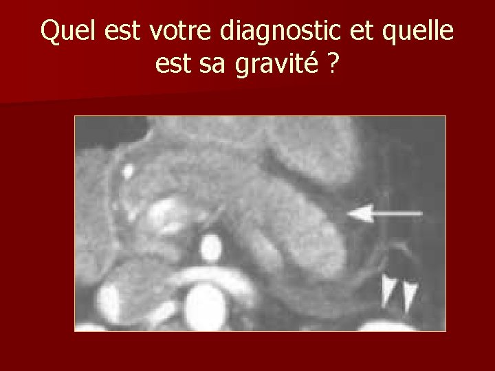 Quel est votre diagnostic et quelle est sa gravité ? Quel est votre diagnostic et quelle est sa gravité ?