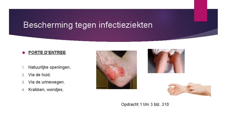 Bescherming tegen infectieziekten PORTE D’ENTREE 1. Natuurlijke openingen. 2. Via de huid. 3. Via