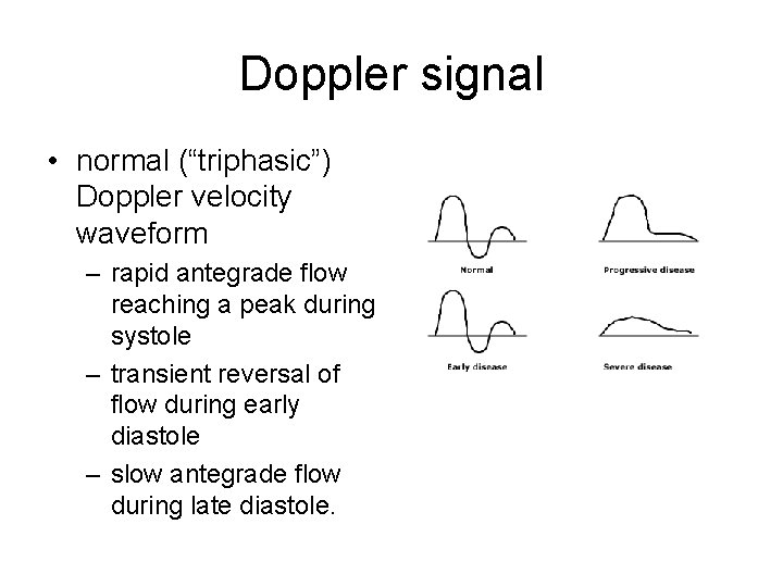 Doppler signal • normal (“triphasic”) Doppler velocity waveform – rapid antegrade flow reaching a