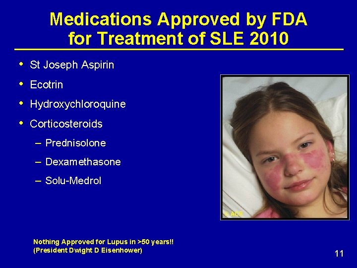 Medications Approved by FDA for Treatment of SLE 2010 • • St Joseph Aspirin