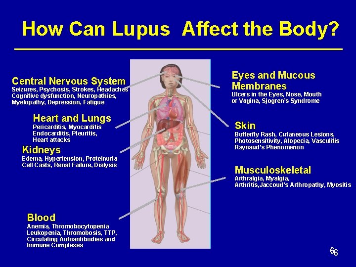 How Can Lupus Affect the Body? Central Nervous System Seizures, Psychosis, Strokes, Headaches Cognitive