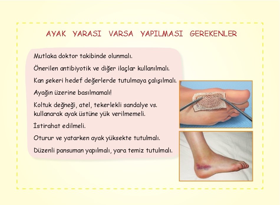 AYAK YARASI VARSA YAPILMASI GEREKENLER Mutlaka doktor takibinde olunmalı. Önerilen antibiyotik ve diğer ilaçlar