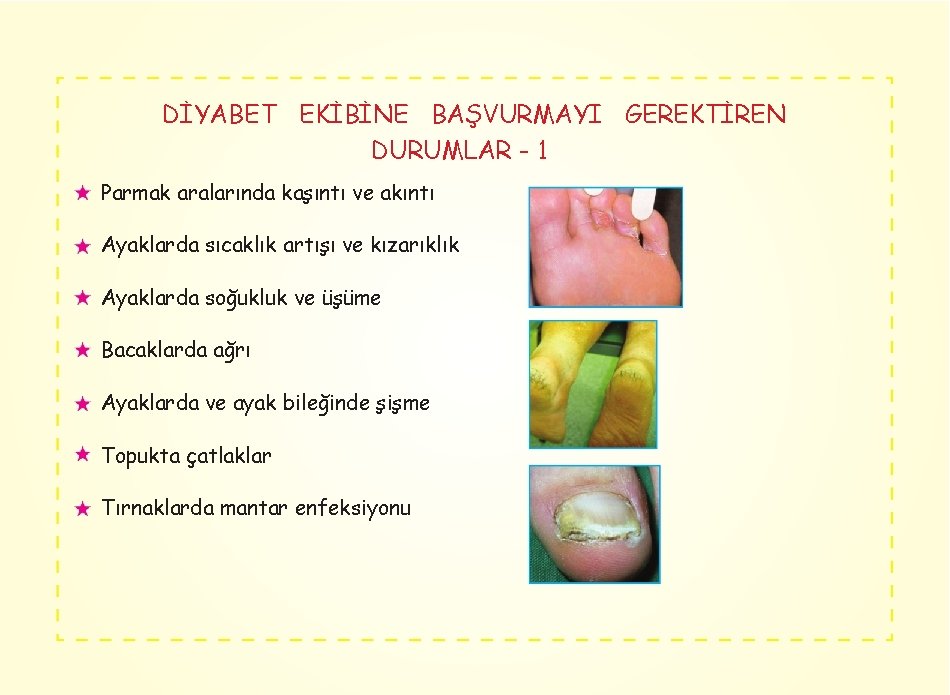 DİYABET EKİBİNE BAŞVURMAYI GEREKTİREN DURUMLAR - 1 Parmak aralarında kaşıntı ve akıntı Ayaklarda sıcaklık