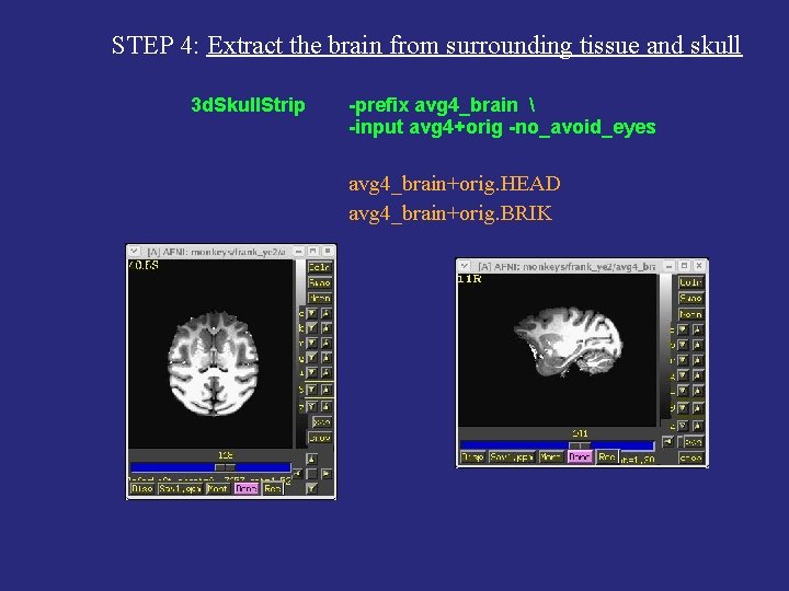 STEP 4: Extract the brain from surrounding tissue and skull 3 d. Skull. Strip