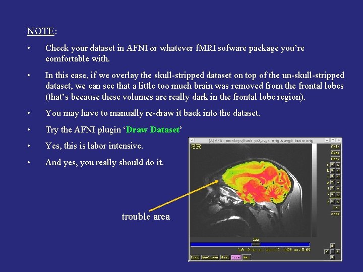 NOTE: • Check your dataset in AFNI or whatever f. MRI sofware package you’re