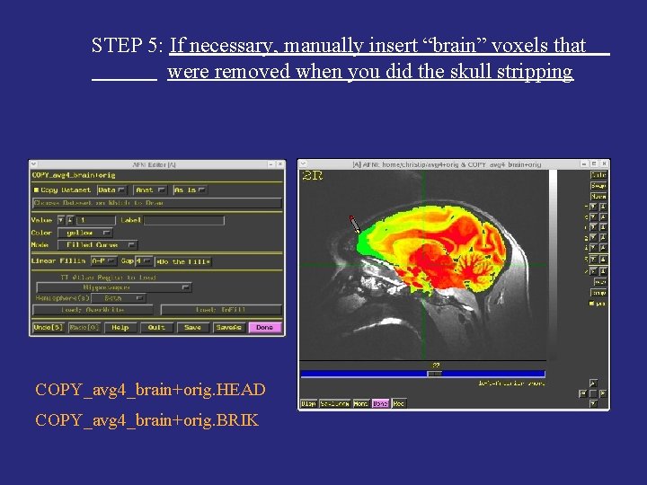 STEP 5: If necessary, manually insert “brain” voxels that were removed when you did